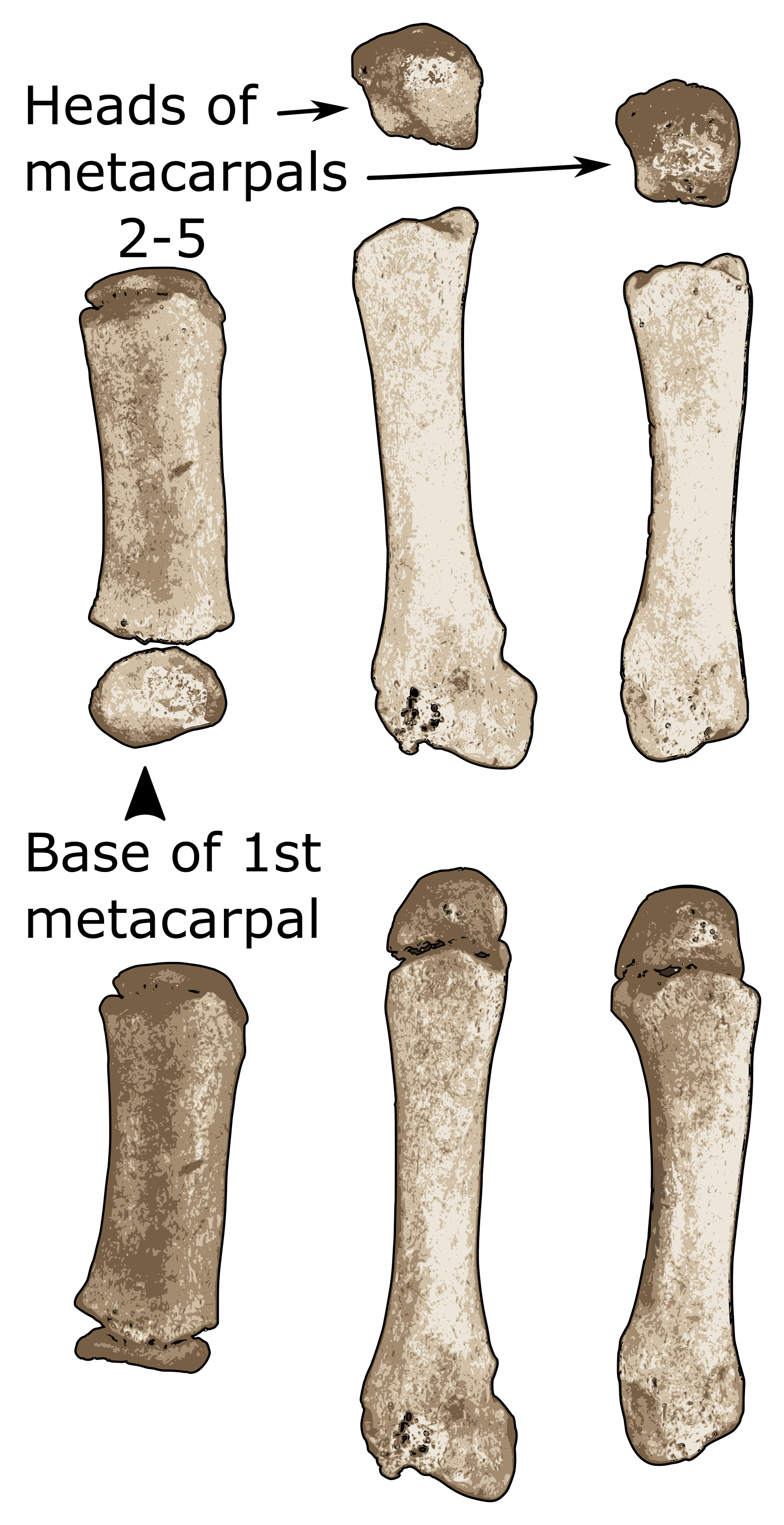 Metacarpals