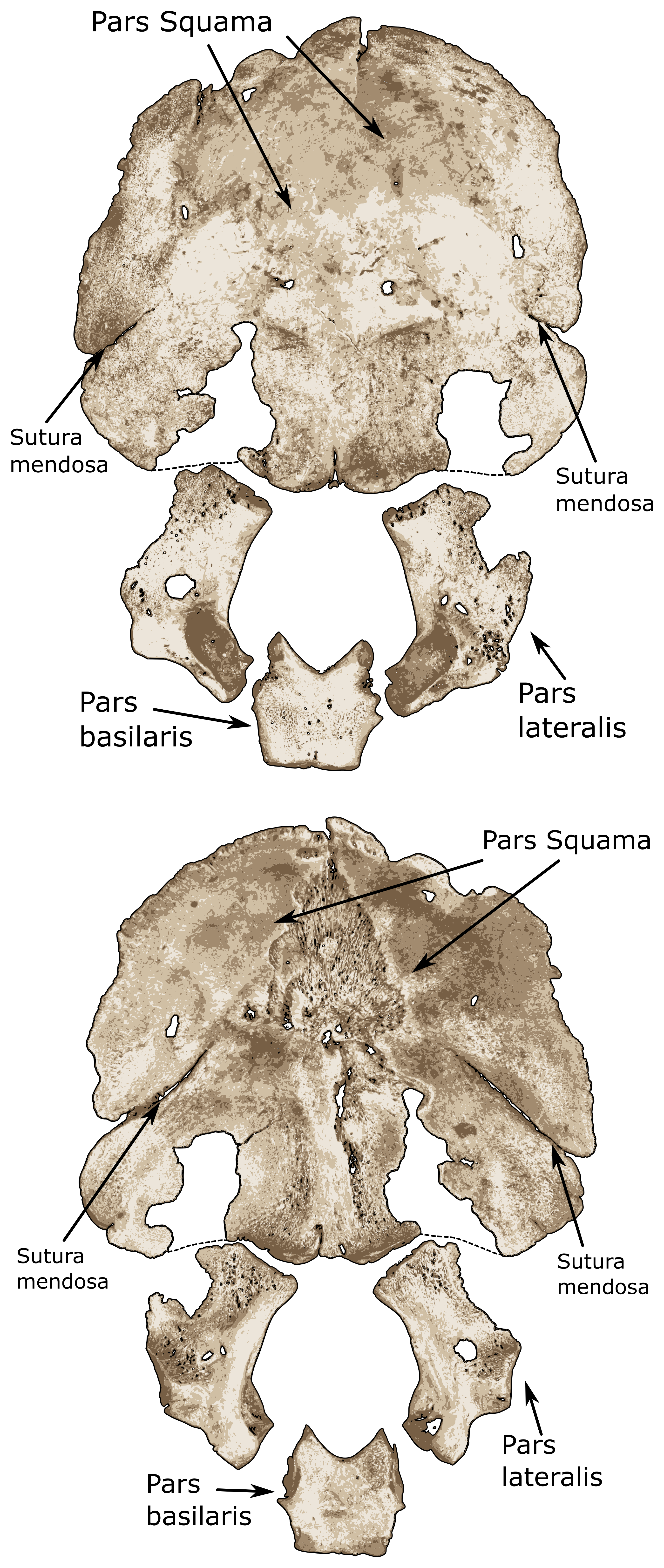 Perinatal occipital bones, ectocranial view